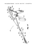 Surgical Stapler diagram and image