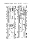 Surgical Stapler diagram and image