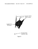 3D TISSUE MODEL FORMATION FROM NON-PARALLEL 2D IMAGES diagram and image