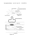 VALIDATION EMBEDDED SEGMENTATION METHOD FOR VASCULAR ULTRASOUND IMAGES diagram and image