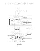 VALIDATION EMBEDDED SEGMENTATION METHOD FOR VASCULAR ULTRASOUND IMAGES diagram and image