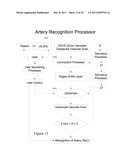 VALIDATION EMBEDDED SEGMENTATION METHOD FOR VASCULAR ULTRASOUND IMAGES diagram and image