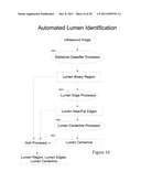 VALIDATION EMBEDDED SEGMENTATION METHOD FOR VASCULAR ULTRASOUND IMAGES diagram and image