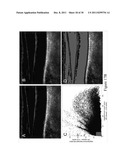 VALIDATION EMBEDDED SEGMENTATION METHOD FOR VASCULAR ULTRASOUND IMAGES diagram and image