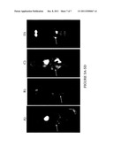 METHODS FOR INCREASING EFFICACY OF RADIOIMMUNOTHERAPY OF MELANOMA diagram and image