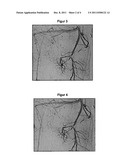 METHOD FOR TREATING A PATIENT diagram and image