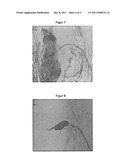 METHOD FOR TREATING A PATIENT diagram and image