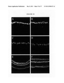 PHARMACOLOGICAL VITREOLYSIS diagram and image