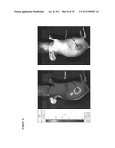 ANTIOXIDANT CAMPTOTHECIN DERIVATIVES AND ANTIOXIDANT ANTINEOPLASTIC     NANOSPHERES THEREOF diagram and image