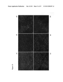 ANTIOXIDANT CAMPTOTHECIN DERIVATIVES AND ANTIOXIDANT ANTINEOPLASTIC     NANOSPHERES THEREOF diagram and image