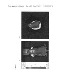 ANTIOXIDANT CAMPTOTHECIN DERIVATIVES AND ANTIOXIDANT ANTINEOPLASTIC     NANOSPHERES THEREOF diagram and image