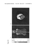 ANTIOXIDANT CAMPTOTHECIN DERIVATIVES AND ANTIOXIDANT ANTINEOPLASTIC     NANOSPHERES THEREOF diagram and image