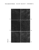 ANTIOXIDANT CAMPTOTHECIN DERIVATIVES AND ANTIOXIDANT ANTINEOPLASTIC     NANOSPHERES THEREOF diagram and image