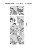 CARTILAGE REGENERATION WITHOUT CELL TRANSPLANTATION diagram and image