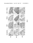 CARTILAGE REGENERATION WITHOUT CELL TRANSPLANTATION diagram and image