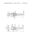 Device for Fixing Orthodontic Devices diagram and image