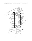 Device for Fixing Orthodontic Devices diagram and image