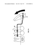 Device for Fixing Orthodontic Devices diagram and image