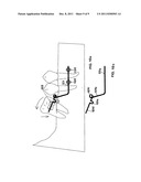 Device for Fixing Orthodontic Devices diagram and image