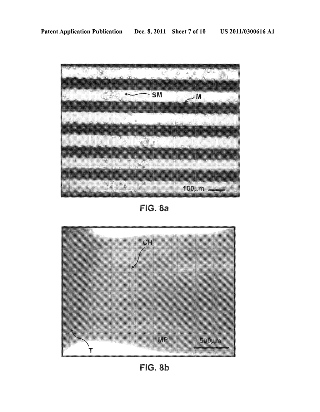 METHOD FOR CREATING PERFUSABLE MICROVESSEL SYSTEMS - diagram, schematic, and image 08