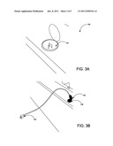 E-Z RETRACTABLE CORD SYSTEM diagram and image