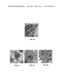 COMPOSITIONS AND METHODS FOR DIAGNOSING AND TREATING CANCER AND     NEURODEGENERATIVE DISEASES RELATED TO BECLIN-1 diagram and image