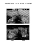 Methods of treatment utilising glucan formulations diagram and image