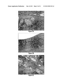 Methods of treatment utilising glucan formulations diagram and image