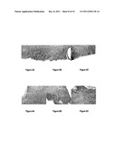 Methods of treatment utilising glucan formulations diagram and image