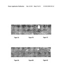 Methods of treatment utilising glucan formulations diagram and image