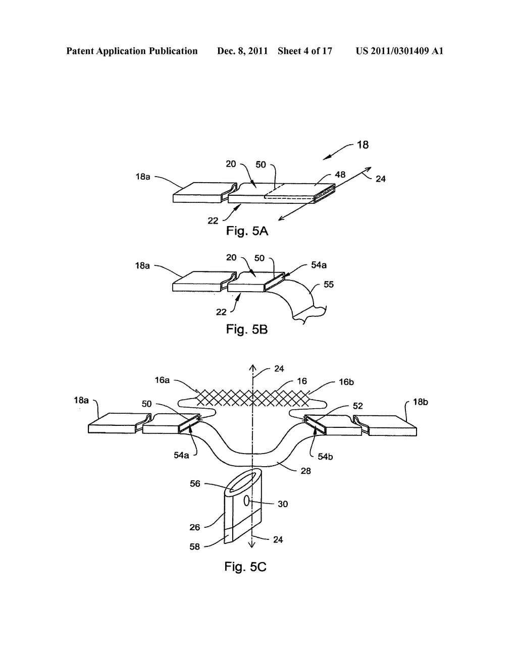 SYSTEMS AND METHODS FOR SLING DELIVERY AND PLACEMENT - diagram, schematic, and image 05