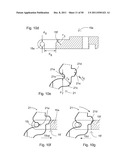 SURGICAL RETRACTOR diagram and image