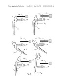 SURGICAL RETRACTOR diagram and image
