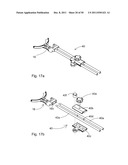 SURGICAL RETRACTOR diagram and image