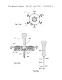 SURGICAL RETRACTOR diagram and image