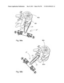 SURGICAL RETRACTOR diagram and image