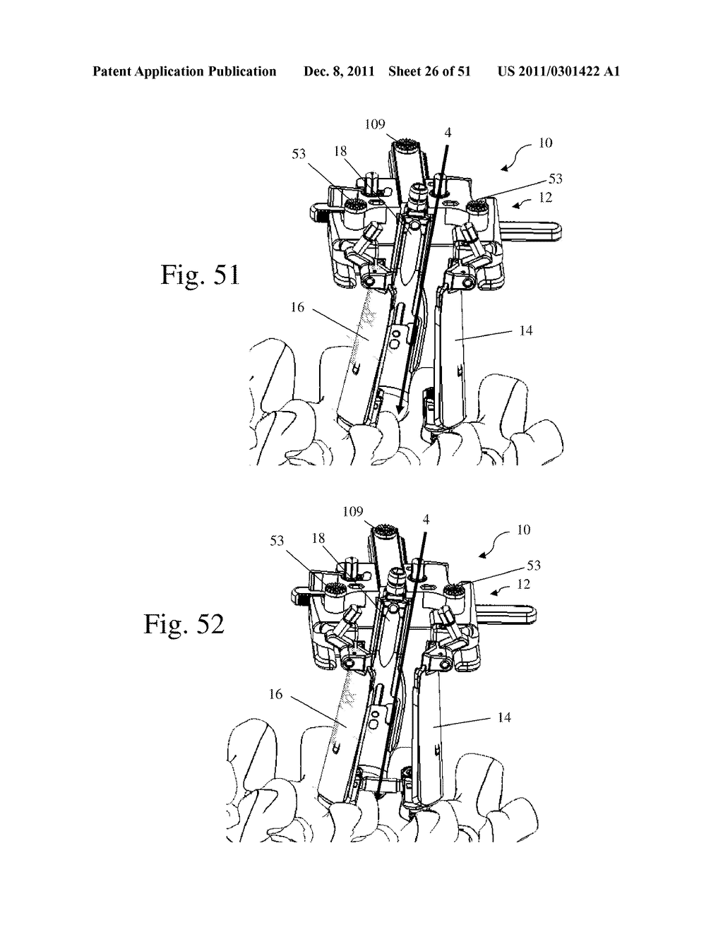 Method and Apparatus for Performing Spinal fusion Surgery - diagram, schematic, and image 27