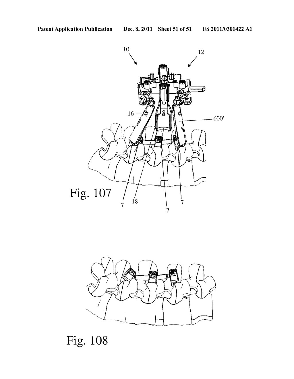 Method and Apparatus for Performing Spinal fusion Surgery - diagram, schematic, and image 52