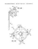 SURGICAL RETRACTOR SYSTEMS diagram and image