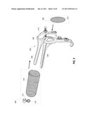 Vaginal Cuff Closure Systems, And Related Method For Knot-Free     Laparoscopic Hysterectomy diagram and image