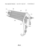 Vaginal Cuff Closure Systems, And Related Method For Knot-Free     Laparoscopic Hysterectomy diagram and image