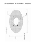 MEDICAL ULTRASOUND 2-D TRANSDUCER ARRAY ARCHITECTURE: SPOT OF ARAGO diagram and image