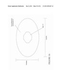 MEDICAL ULTRASOUND 2-D TRANSDUCER ARRAY ARCHITECTURE: SPOT OF ARAGO diagram and image