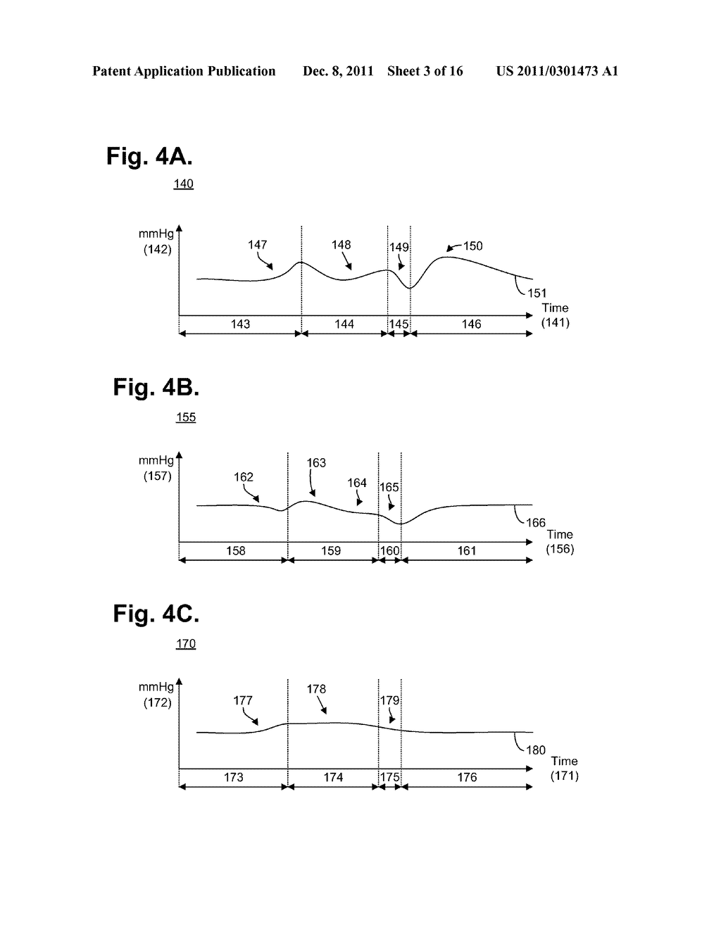 SYSTEM AND METHOD FOR ASSESSING CARDIAC PERFORMANCE THROUGH CARDIAC     VIBRATION MONITORING - diagram, schematic, and image 04