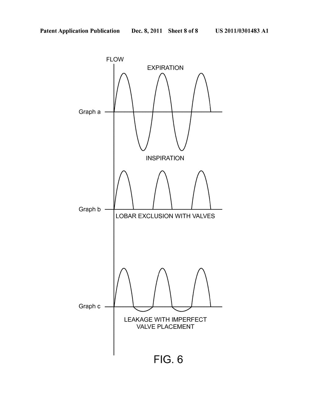 LOCAL LUNG MEASUREMENT AND TREATMENT - diagram, schematic, and image 09