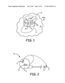 METHOD AND APPARATUS FOR DETECTING CHANGE IN INTRATHORACIC ELECTRICAL     IMPEDANCE diagram and image