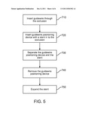 IN-VESSEL POSITIONING DEVICE diagram and image