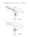 IN-VESSEL POSITIONING DEVICE diagram and image