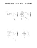 TRANSURETHRAL ULTRASOUND PROBE FOR TREATMENT OF PROSTATE diagram and image