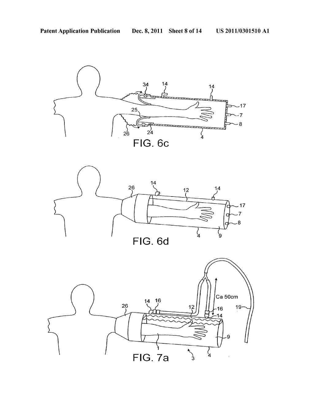 DEVICE FOR APPLYING A PULSATING PRESSURE TO A LOCAL REGION OF THE BODY AND     THE APPLICATIONS THEREOF - diagram, schematic, and image 09